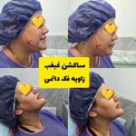 تزریق و ساکشن چربی درمطب