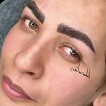 فیبروز میکرو شیدینگ لب خط چشم ریموو تک جلسه
