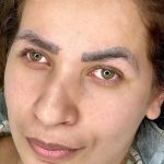 فیبروز میکرو شیدینگ لب خط چشم ریموو تک جلسه