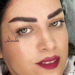 فیبروز میکرو شیدینگ لب خط چشم ریموو تک جلسه